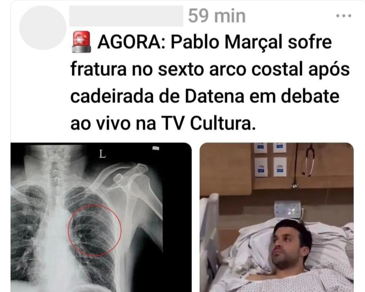 Post engana ao usar registro de banco de imagem e associar a uma suposta fratura no tórax do candidato Pablo Marçal (PRTB) após receber cadeirada de Datena (PSDB)