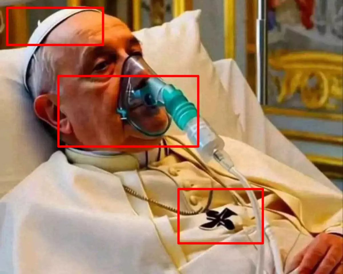 Papa Francisco está deitado em uma maca de hospital, usando vestimentas religiosas e com máscara de oxigênio sobre o rosto. Retângulos vermelhos apontam diversos indícios de que a imagem foi gerada por IA, como crucifixo deformado e ausência de elástico em máscara