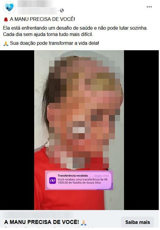 Print mostra criança, que usa uma camiseta vermelha, com o rosto e o pescoço repleto de bolhas. Legenda enganosa diz: ‘A MANU PRECISA DE VOCÊ! Ela está enfrentando um desafio de saúde e não pode lutar sozinha. Cada dia sem ajuda torna tudo mais difícil. Sua doação pode transformar a vida dela!’