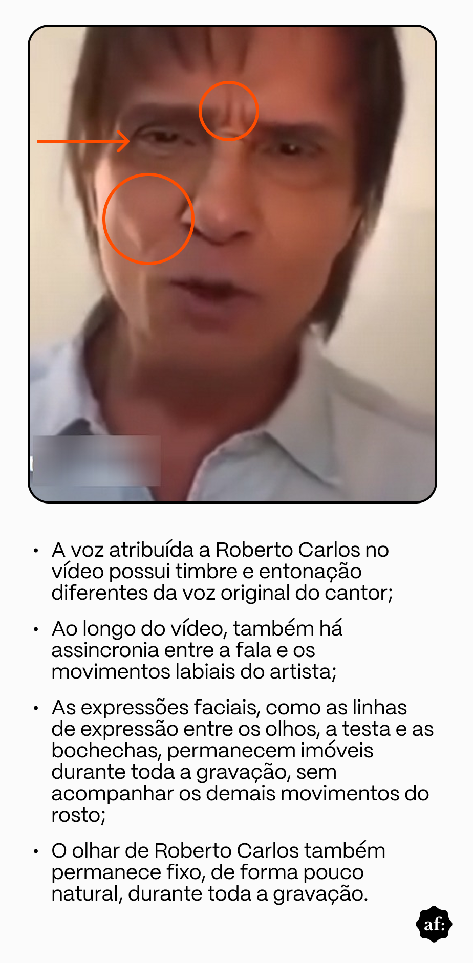 Frame de vídeo gerado por IA em que Roberto Carlos, homem idoso de pele clara, cabelo liso castanho de comprimento médio, aparece vestindo camisa clara. Na imagem, há uma seta e círculos na cor laranja que sinalizam indícios de que o conteúdo foi gerado por IA