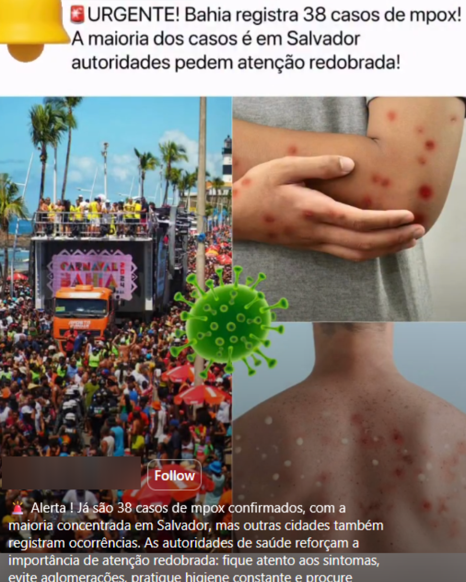 Imagem é uma montagem com três elementos: à esquerda, uma multidão participa de um evento de Carnaval ao ar livre; à direita, aparecem braços e costas de pessoas com lesões cutâneas avermelhadas; e, ao centro, há a ilustração de um vírus. Na parte superior, um texto afirma em tom de alerta que a Bahia registra 38 casos de mpox e pede atenção redobrada das autoridades.
