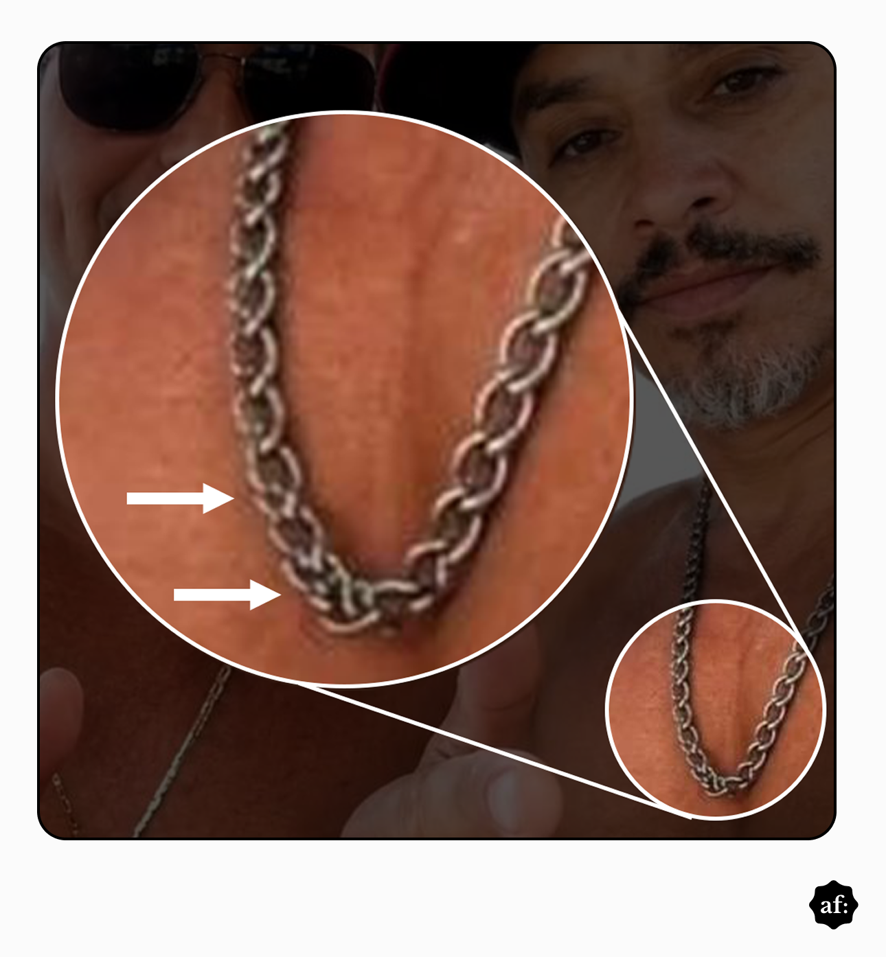 Uma captura de tela de uma montagem de análise de imagem. No centro, um grande círculo exibe um close-up ampliado de uma corrente metálica no pescoço de um homem, com duas setas brancas horizontais apontando para elos distorcidos ou falhos. Um círculo menor no canto inferior direito mostra a área original não ampliada e o fundo desfocado revela dois homens.