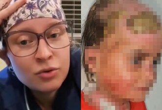 Golpe usa ‘deepfakes’ e imagens de criança doente para roubar dinheiro de doações