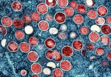 O que é varíola dos macacos e o que se sabe sobre a doença