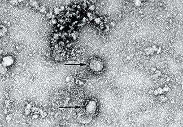 O que se sabe sobre a pandemia do novo coronavírus