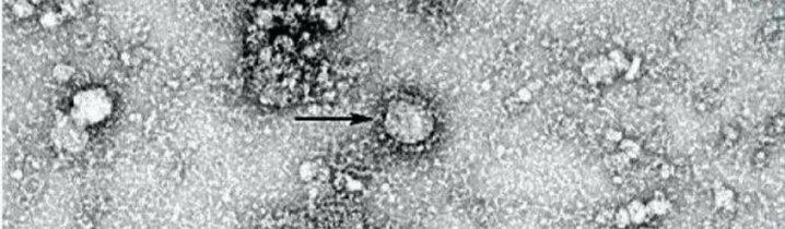 O que se sabe sobre a pandemia do novo coronavírus